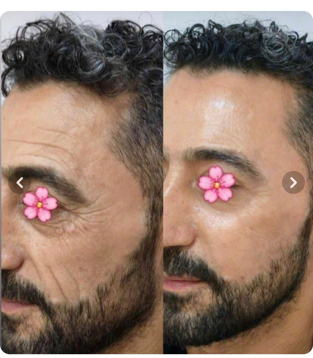 کرم بیوممتیک ویتامین سی ۴۰ میل ضدلک و روشن کننده